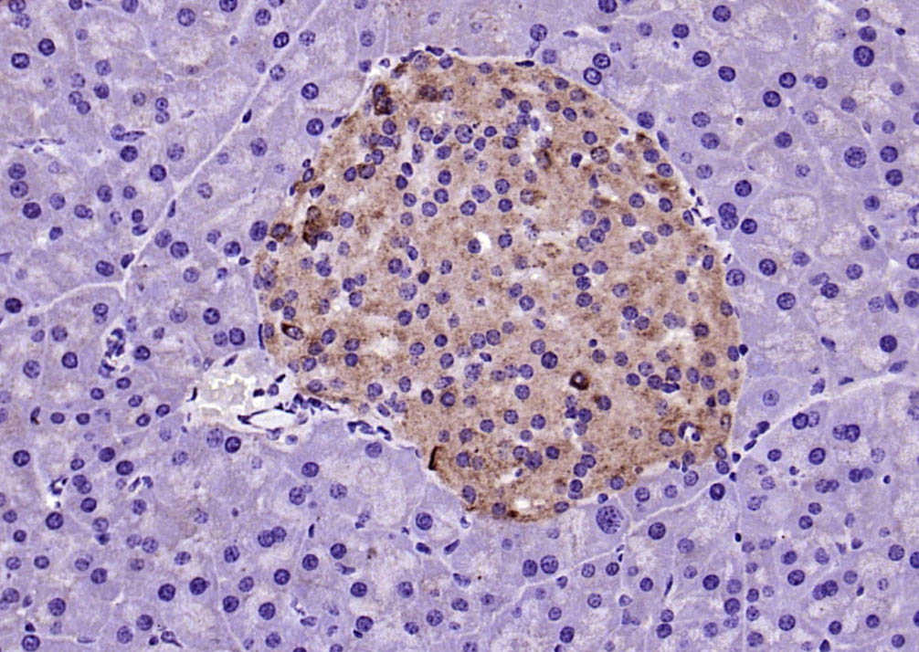 14 - Galectin 9 Rabbit pAb AP94163