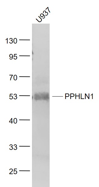 1 - PPHLN1 Rabbit pAb AP94165