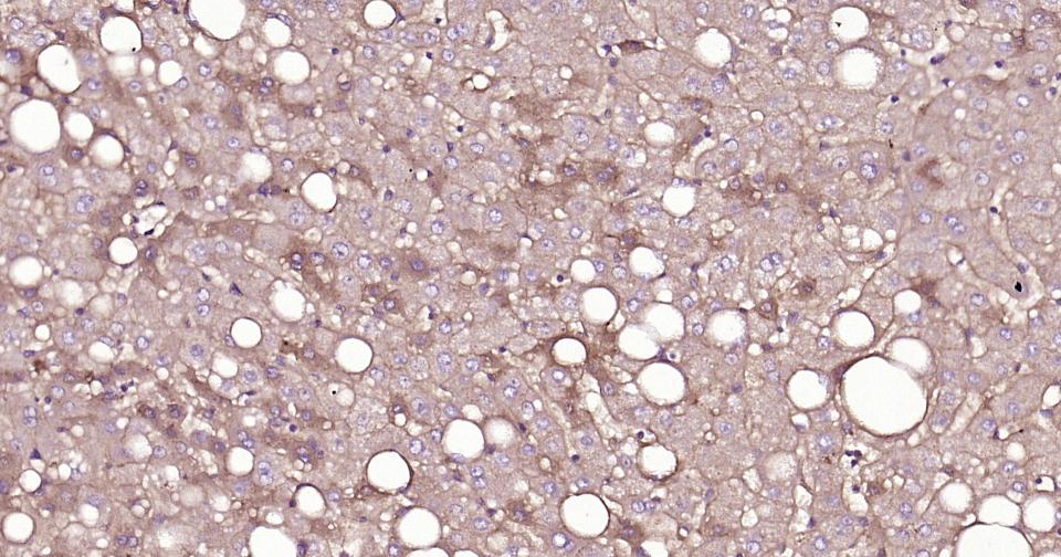 14 - ox-LDL Rabbit pAb AP94170