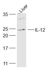 1 - IL12A Rabbit pAb AP94174