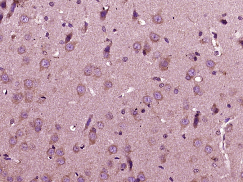 14 - IL12A Rabbit pAb AP94174