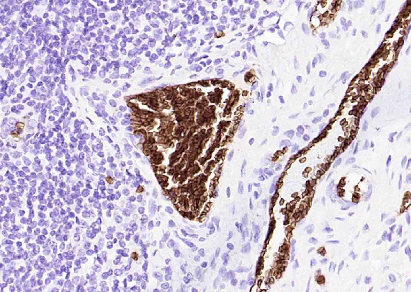 14 - human CD235a (GYPA) Mouse mAb AP94176