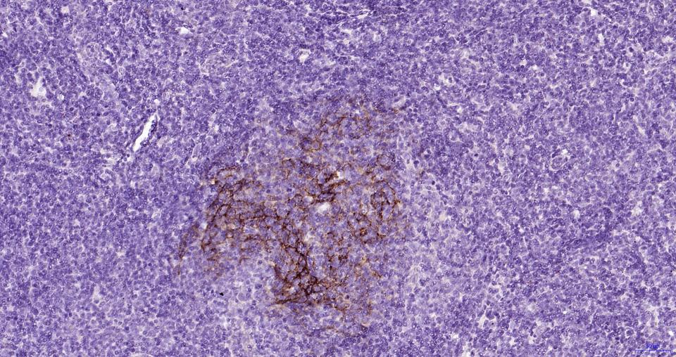 14 - human CD23 Mouse mAb AP94177