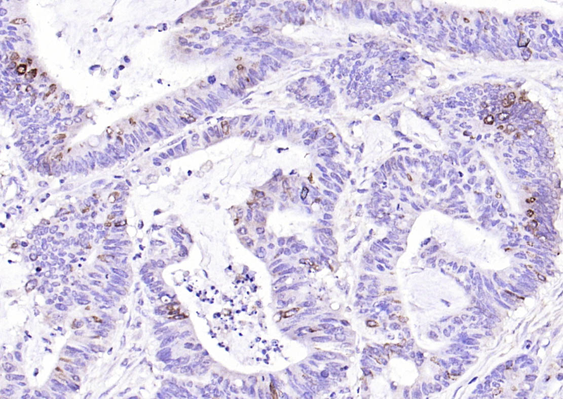 14 - IL13RA2 Rabbit pAb AP94178