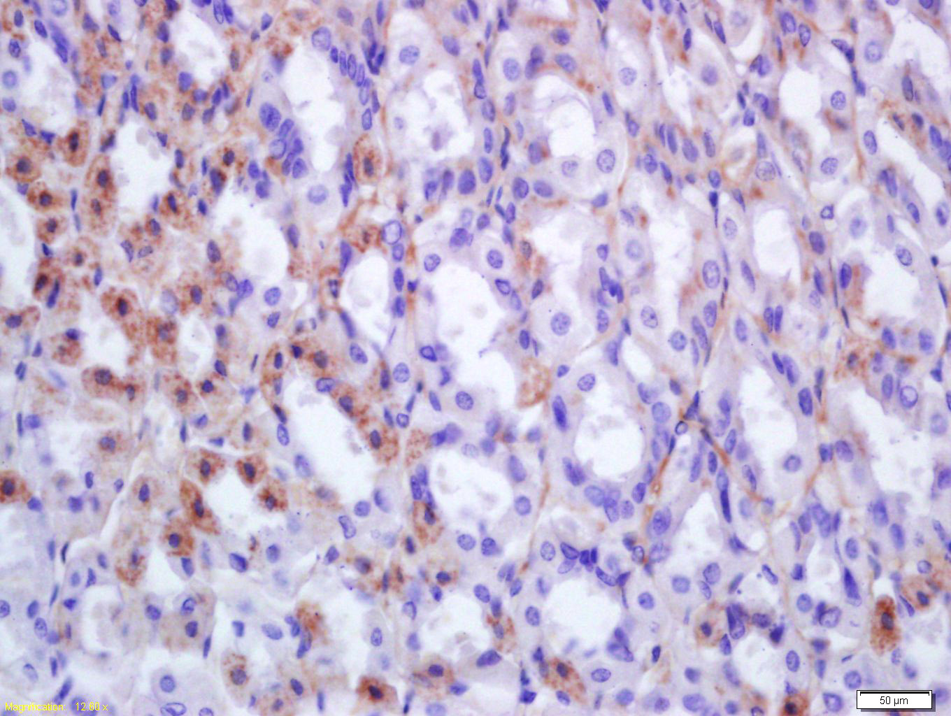 14 - EPX Rabbit pAb AP94182