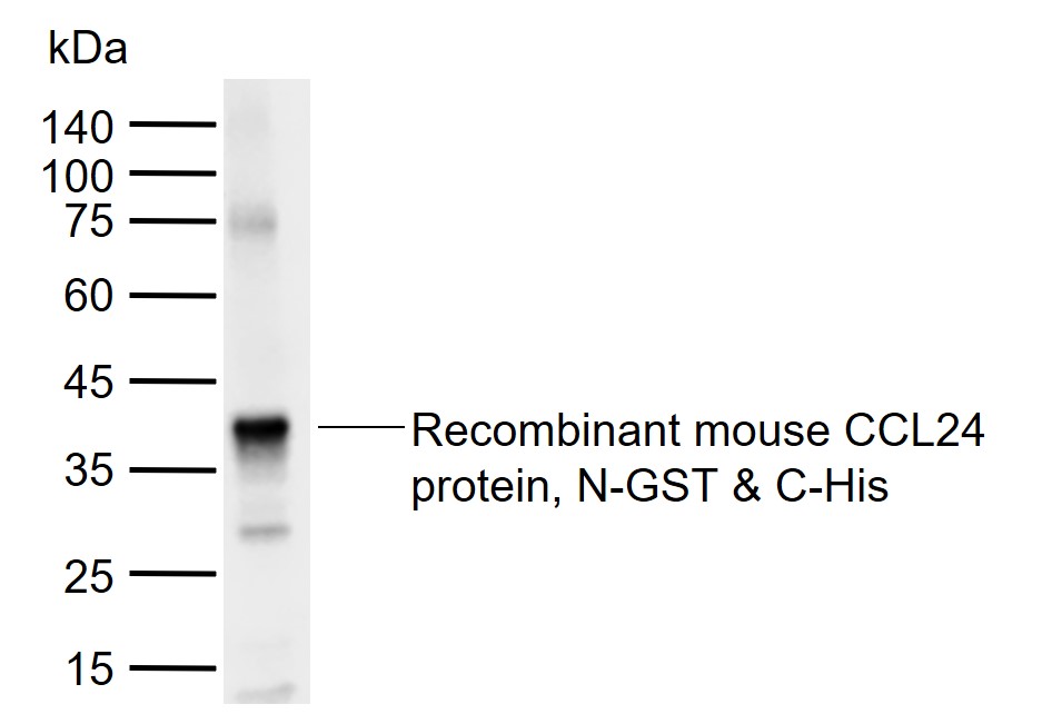 1 - CCL24 Rabbit pAb AP94183