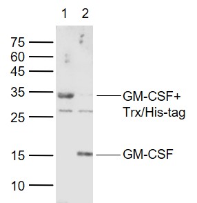1 - GM-CSF Rabbit pAb AP94185