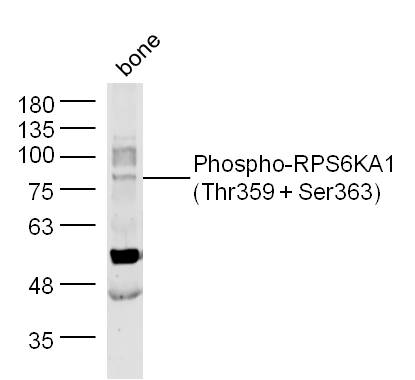 1 - phospho-RPS6KA1 (Thr359 + Ser363) Rabbit pAb AP94192