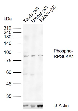 1 - phospho-RPS6KA1 (Thr573) Rabbit pAb AP94193