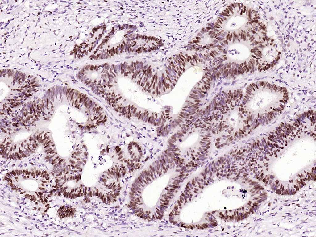14 - PCNA(ready to use) Mouse mAb AP94194
