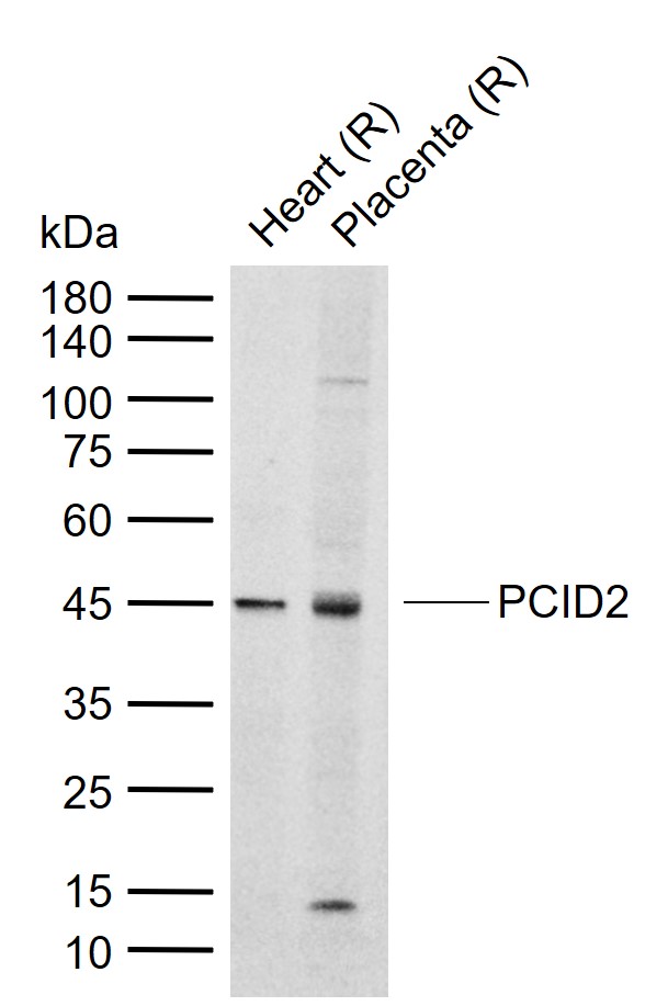 1 - PCID2 Rabbit pAb AP94205