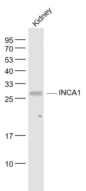 1 - INCA1 Rabbit pAb AP94206