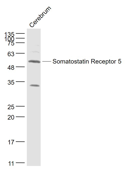 1 - Somatostatin Receptor 5 Rabbit pAb AP94213