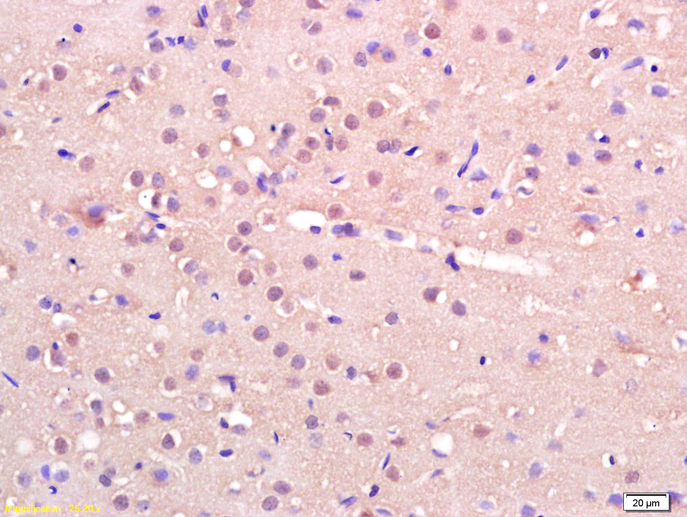 14 - IRX4 Rabbit pAb AP94214