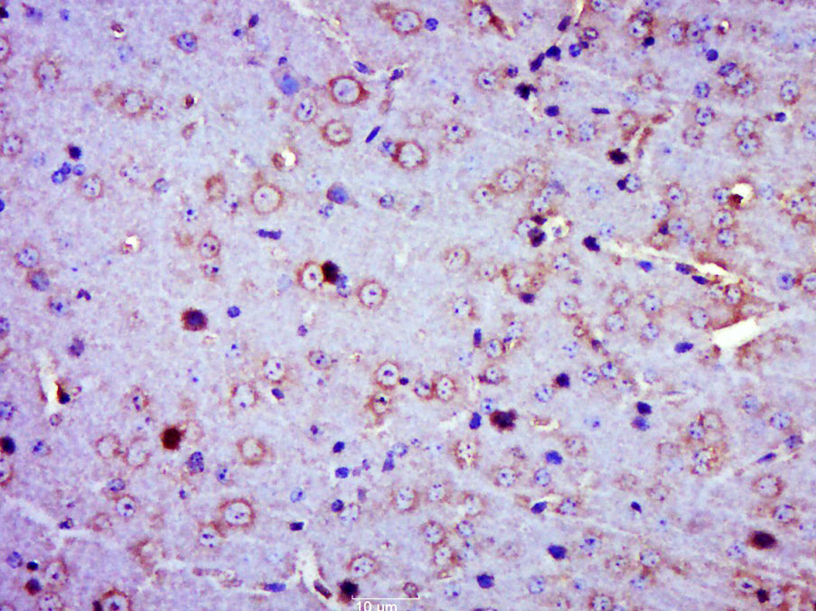 14 - phospho-Calmodulin 1/2/3 (Ser102) Rabbit pAb AP94215