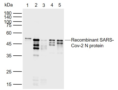 1 - SARS-CoV-2 (2019-nCoV) Nucleocapsid Mouse mAb AP94223