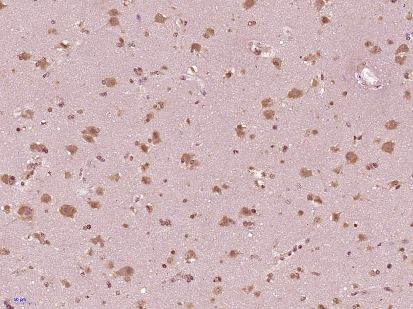 14 - SH2D7 Rabbit pAb AP94226