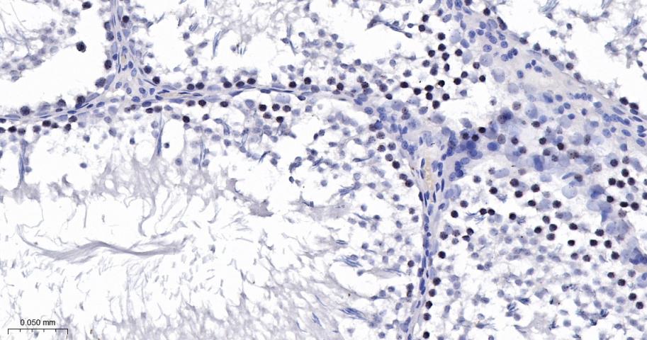 14 - SUV39H2 Recombinant Rabbit mAb AP94254