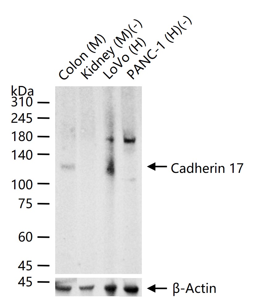 1 - CDH17／LI-cadherin Recombinant Rabbit mAb AP94256