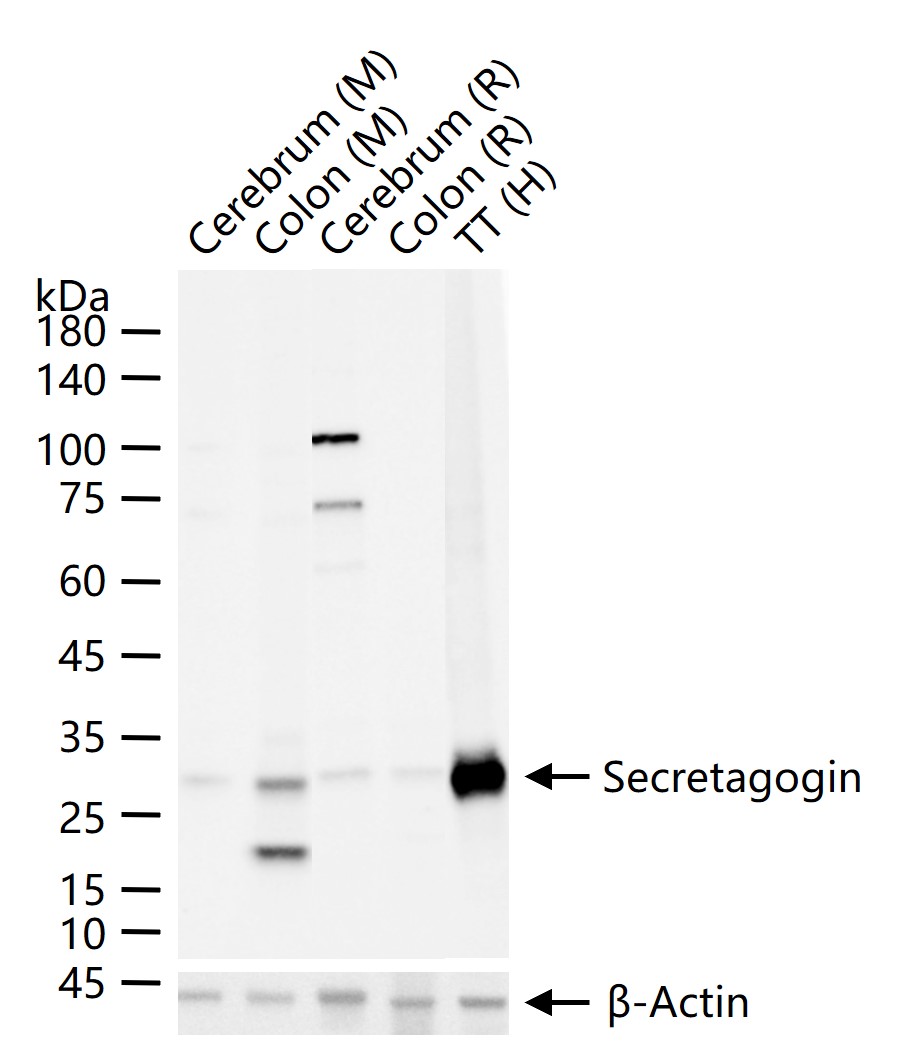 1 - SCGN Recombinant Rabbit mAb AP94257