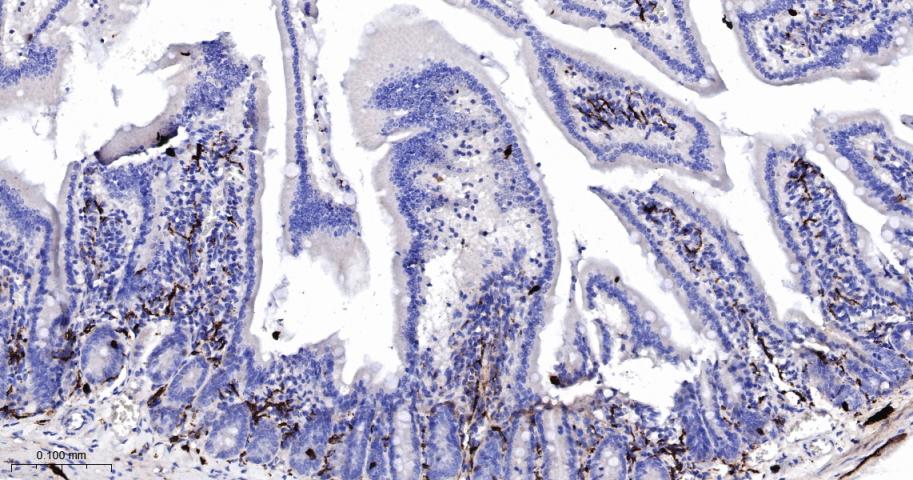 14 - SCGN Recombinant Rabbit mAb AP94257