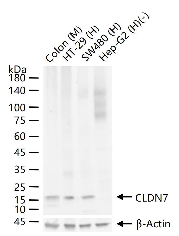 1 - CLDN7 Recombinant Rabbit mAb AP94258