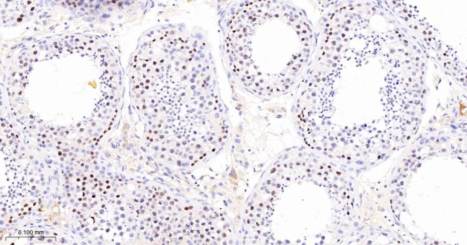 14 - MCM3 Recombinant Rabbit mAb AP94260