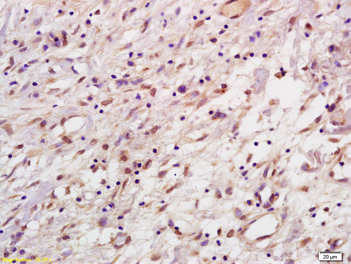 14 - HPV33 E7 Rabbit pAb AP94266