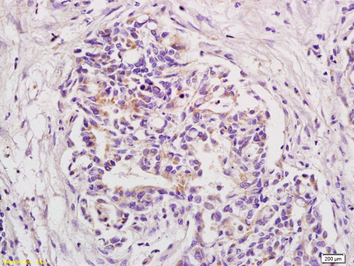 14 - BOD1 Rabbit pAb AP94267