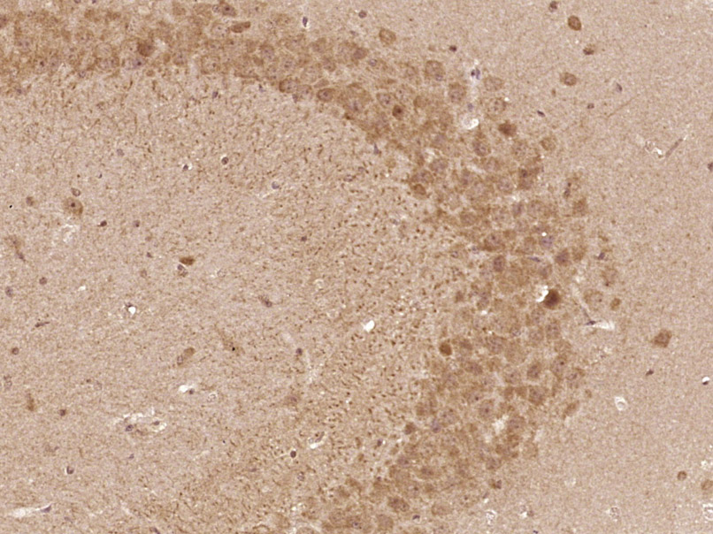 14 - SH2D7 Rabbit pAb AP94268