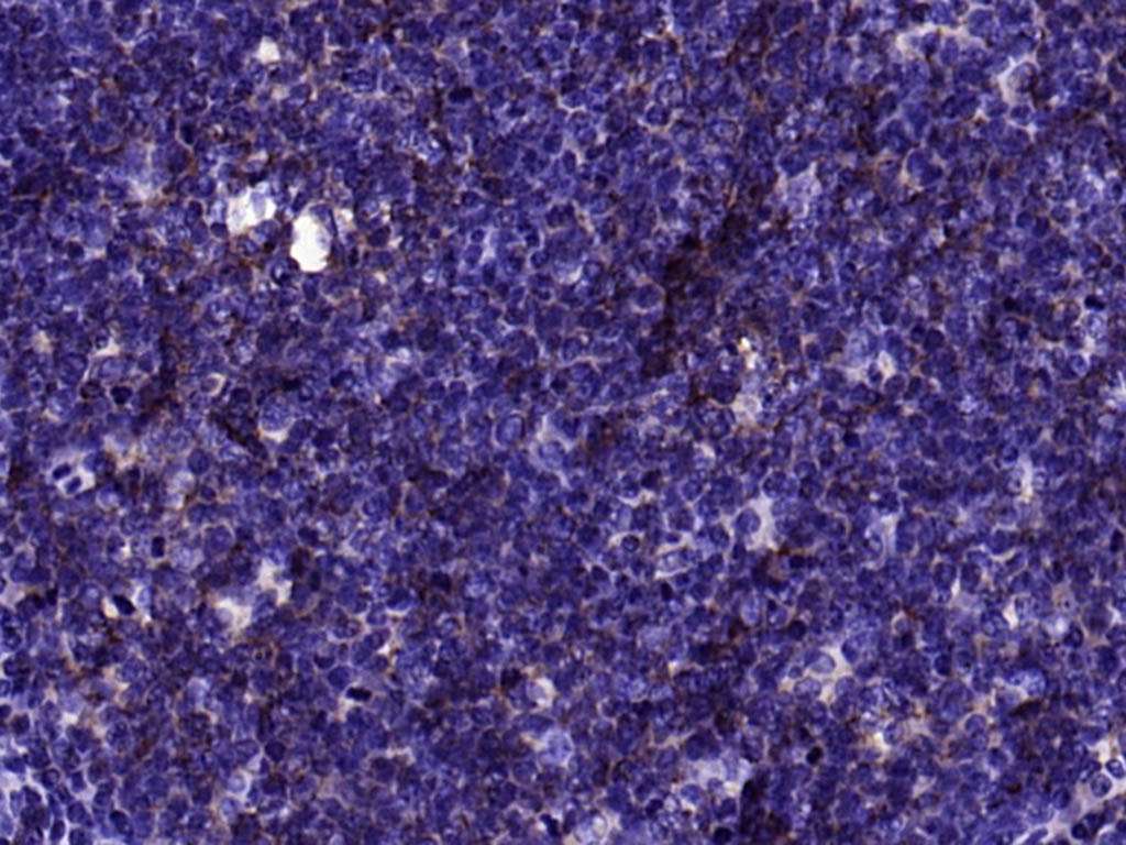14 - Human IgM Recombinant Rabbit mAb AP94270