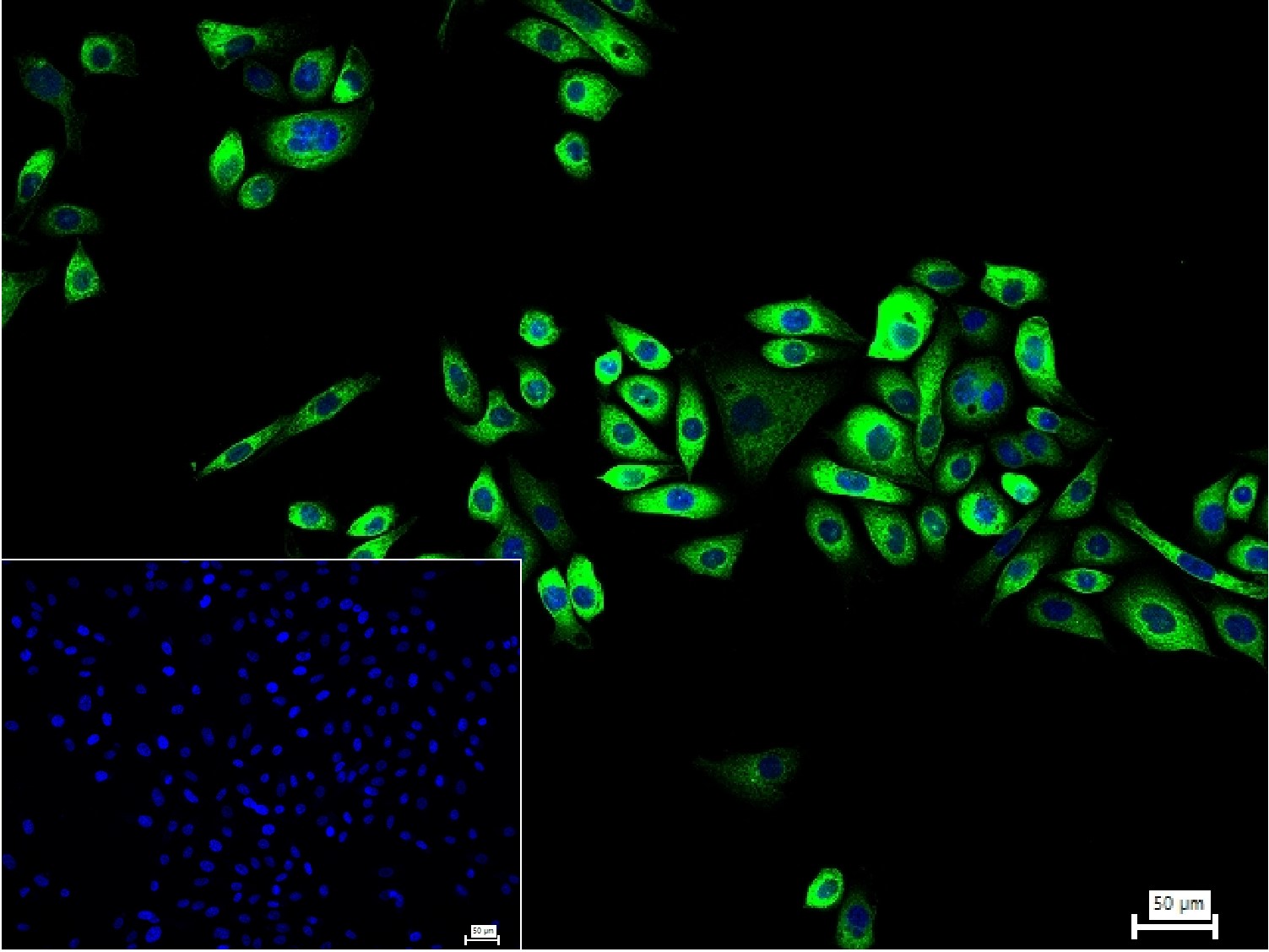 0 - Paxillin Recombinant Rabbit mAb AP94284