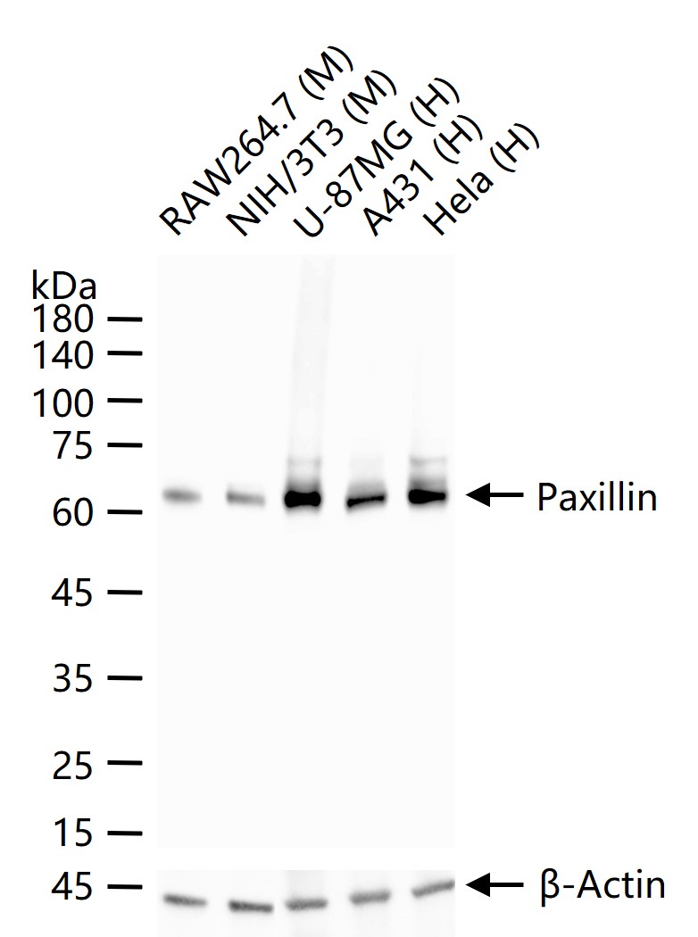 1 - Paxillin Recombinant Rabbit mAb AP94284