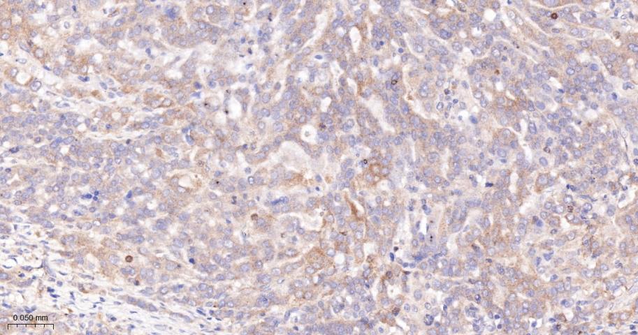 14 - Paxillin Recombinant Rabbit mAb AP94284