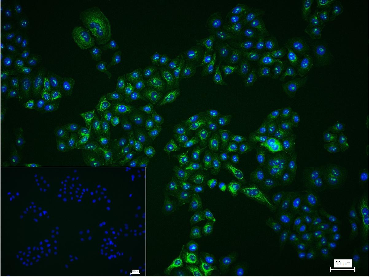 0 - Fibrillarin Recombinant Rabbit mAb AP94290