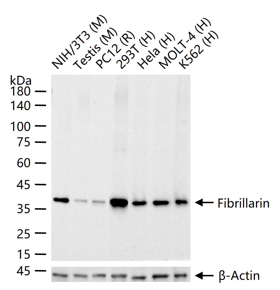 1 - Fibrillarin Recombinant Rabbit mAb AP94290