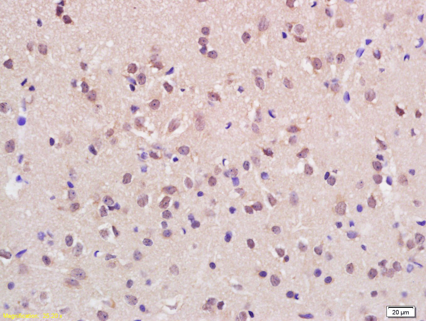 14 - ASH1L Rabbit pAb AP94295