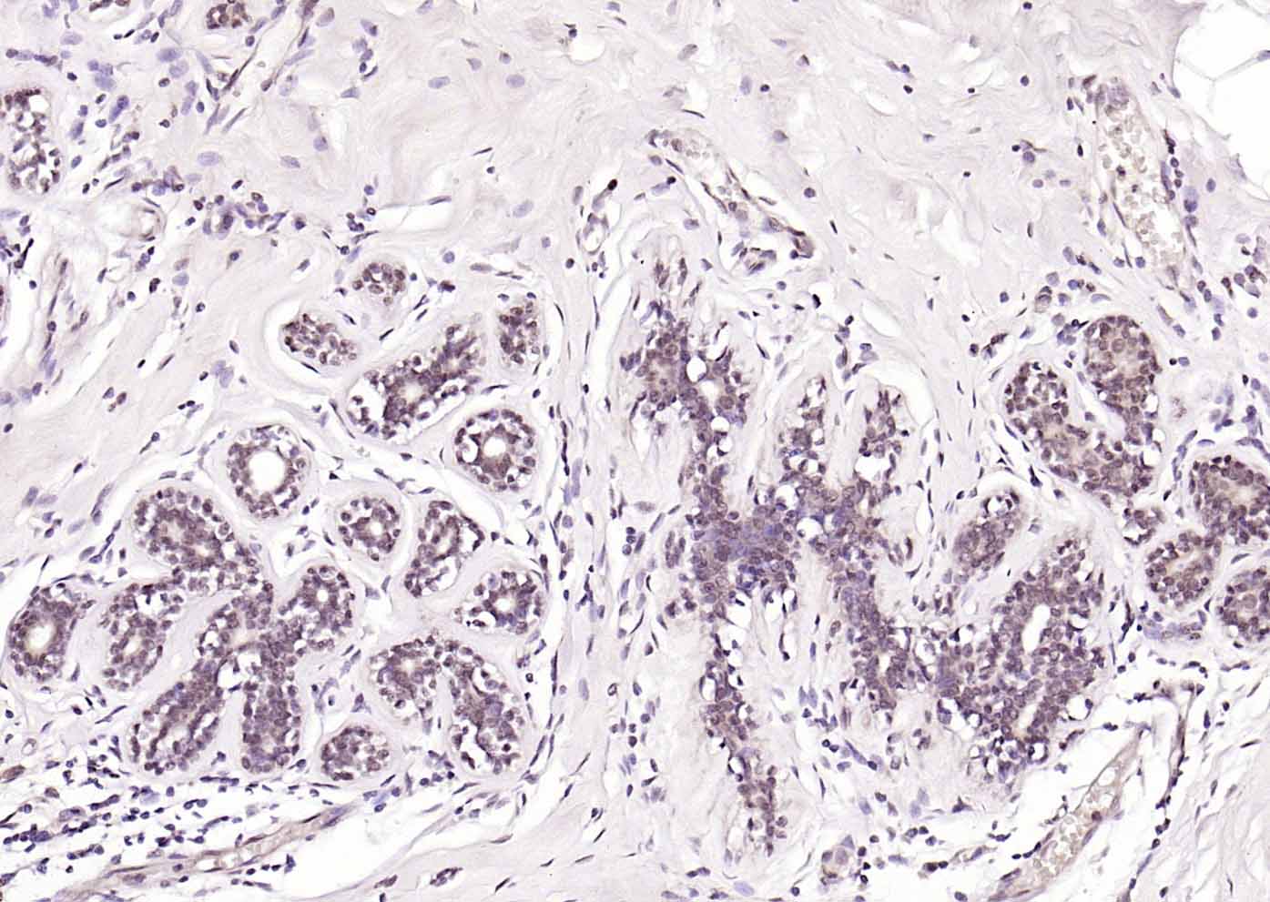 14 - Retinoic acid induced 17 Rabbit pAb AP94296
