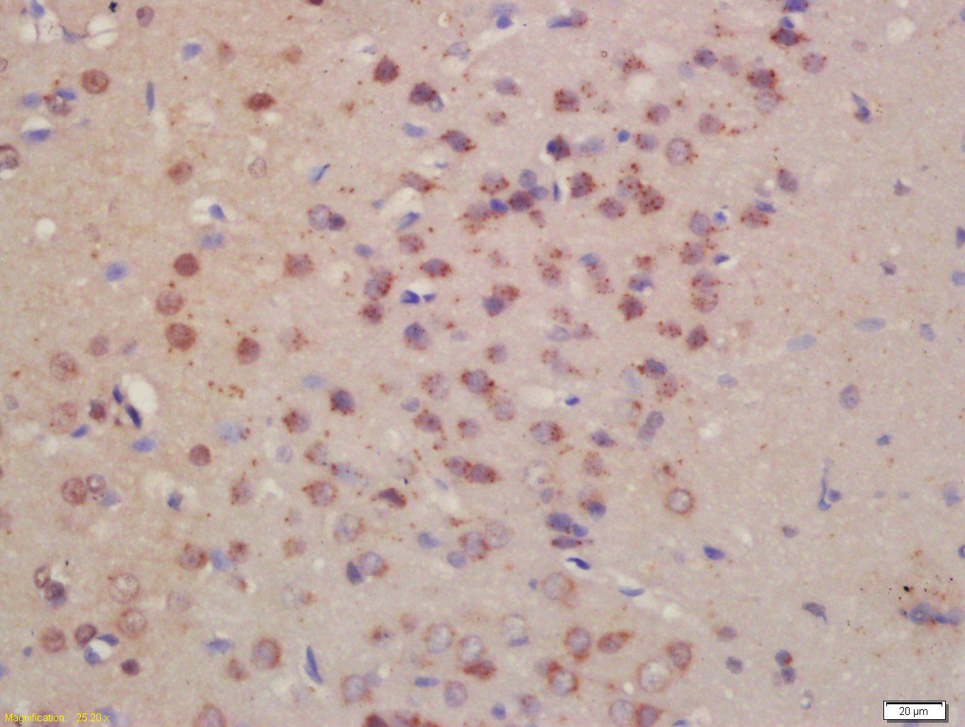 14 - Pro-neuregulin-1, membrane-bound isoform Rabbit pAb AP94299