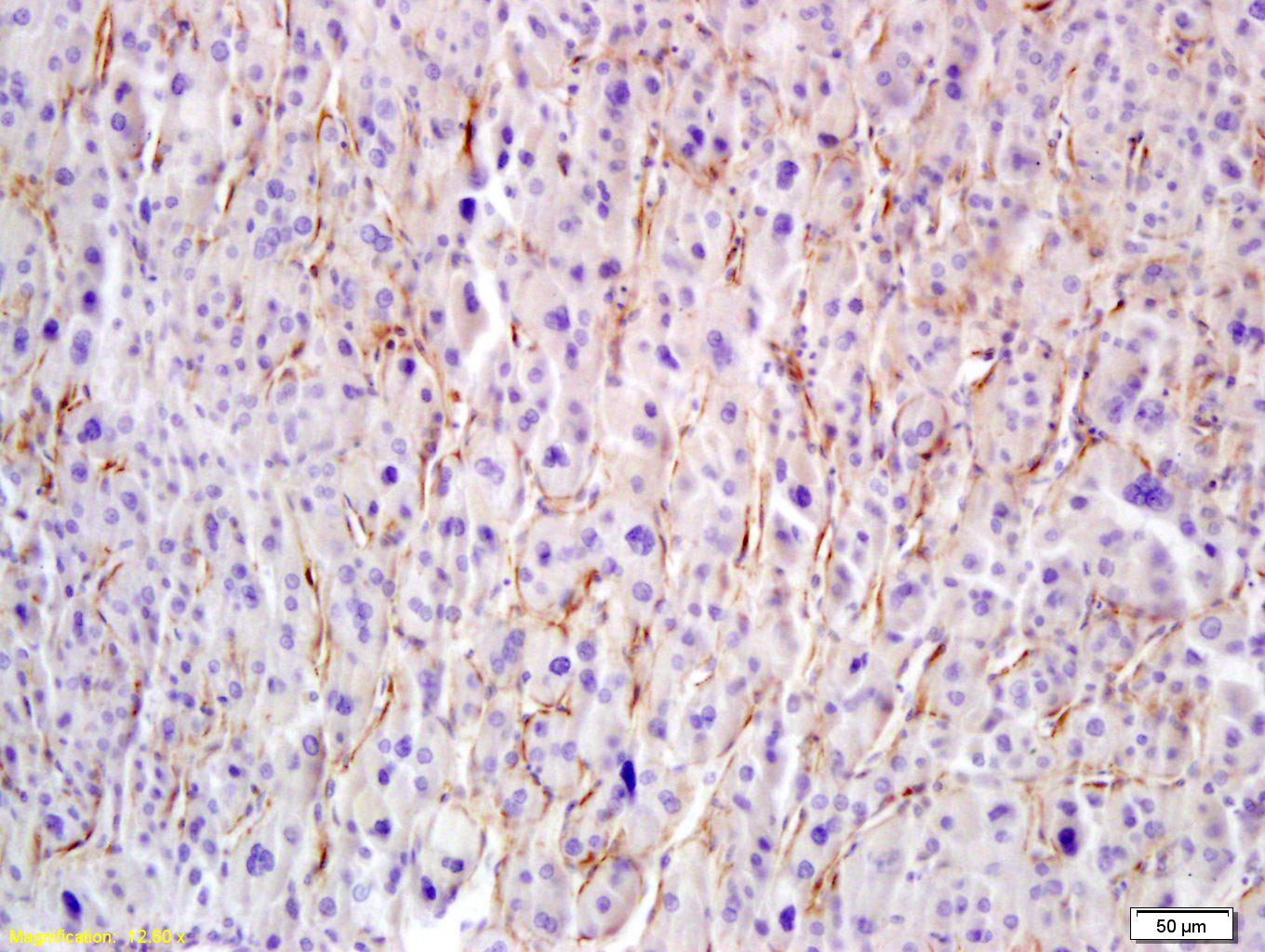 14 - Hyaluronidase-1 Rabbit pAb AP94300