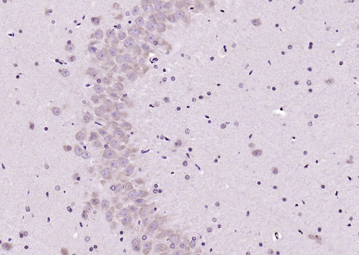 14 - GABA Rabbit pAb AP94301