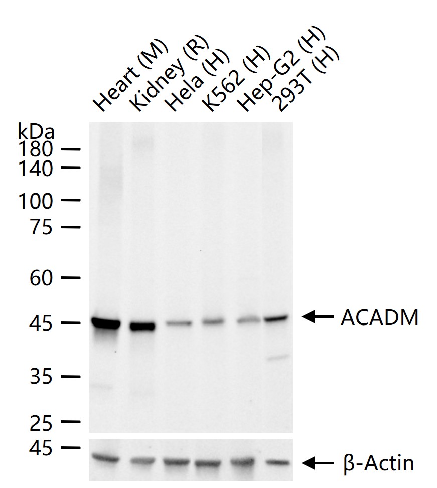 1 - ACADM Recombinant Rabbit mAb AP94306