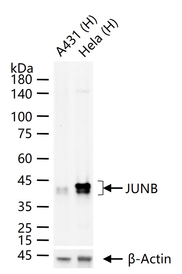 1 - JUNB Recombinant Rabbit mAb AP94316