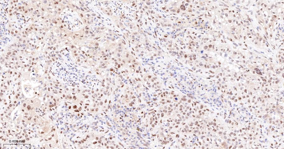 14 - JUNB Recombinant Rabbit mAb AP94316