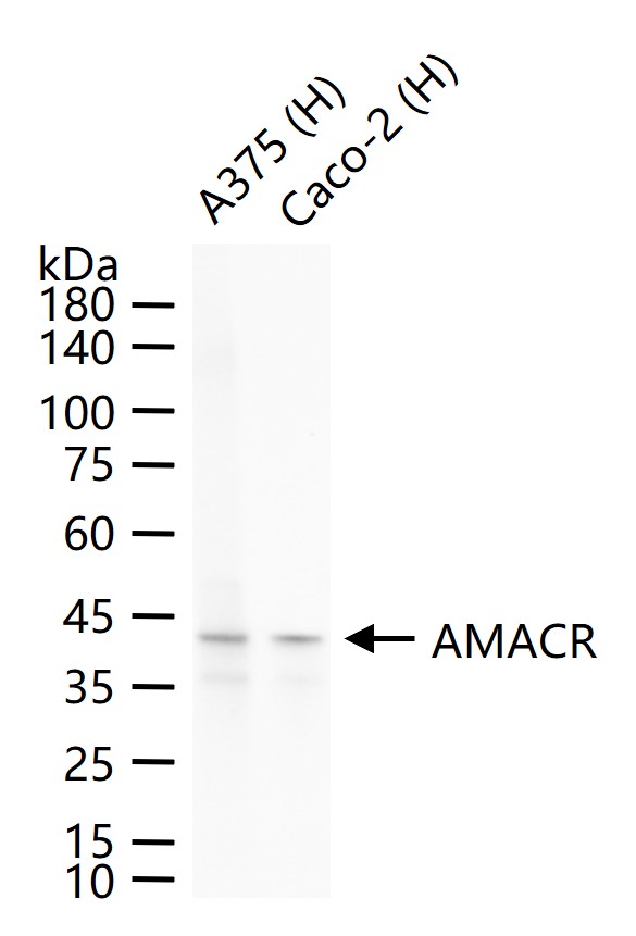 1 - AMACR Recombinant Rabbit mAb AP94317