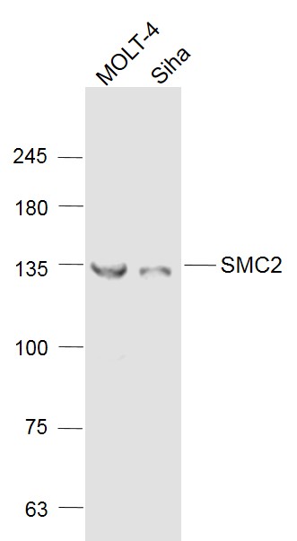 1 - SMC2 Rabbit pAb AP94326