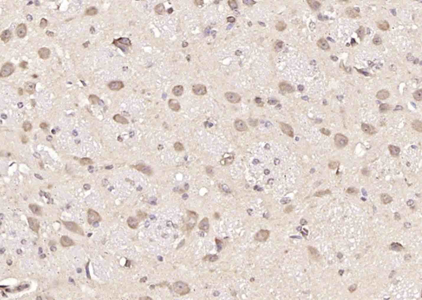 14 - SMC2 Rabbit pAb AP94326