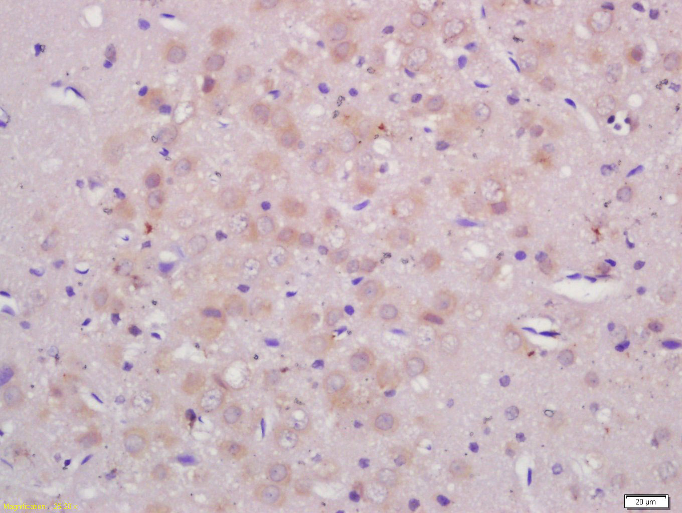 14 - ASB3 Rabbit pAb AP94327