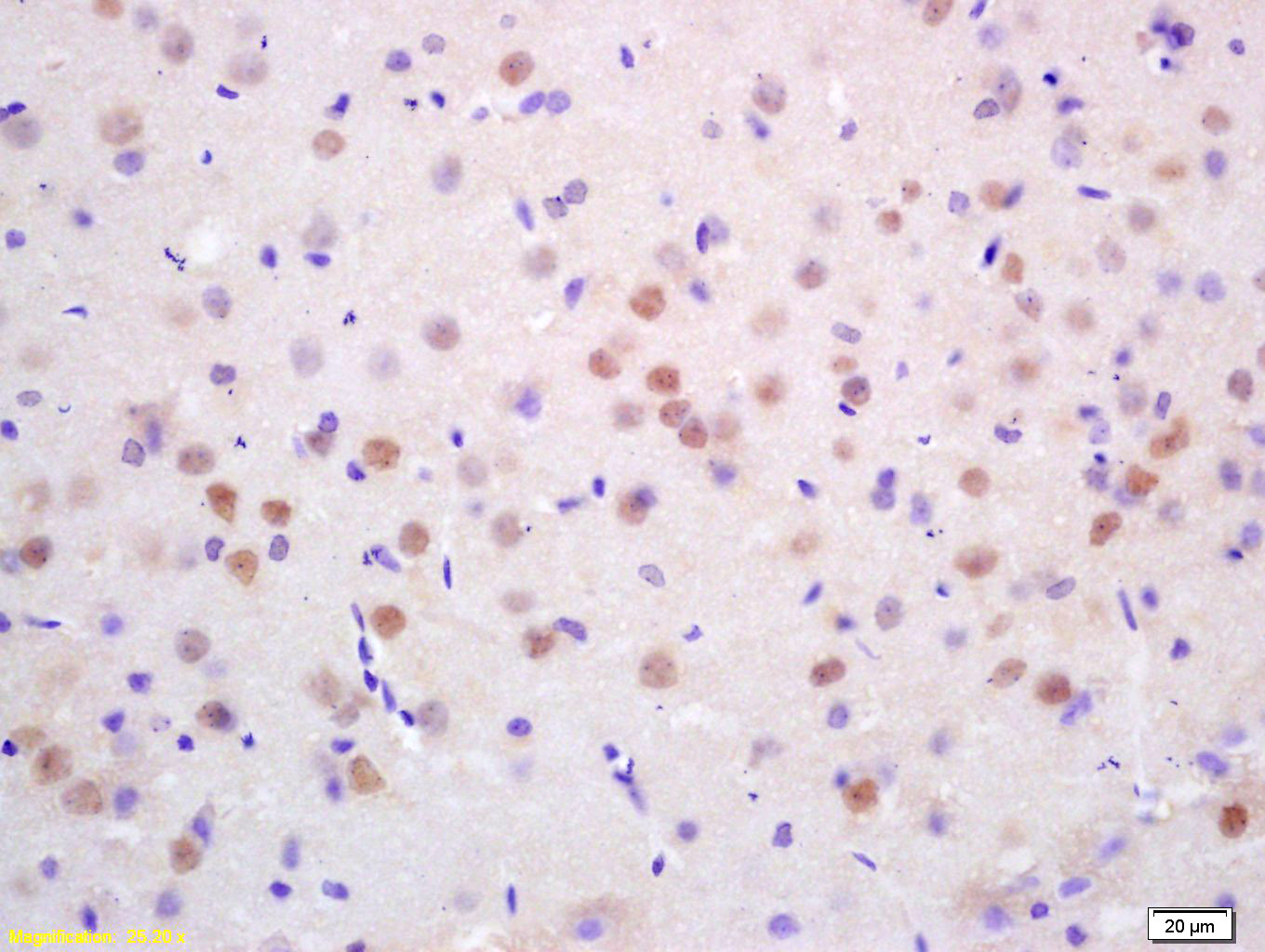 14 - CDC10 Rabbit pAb AP94328