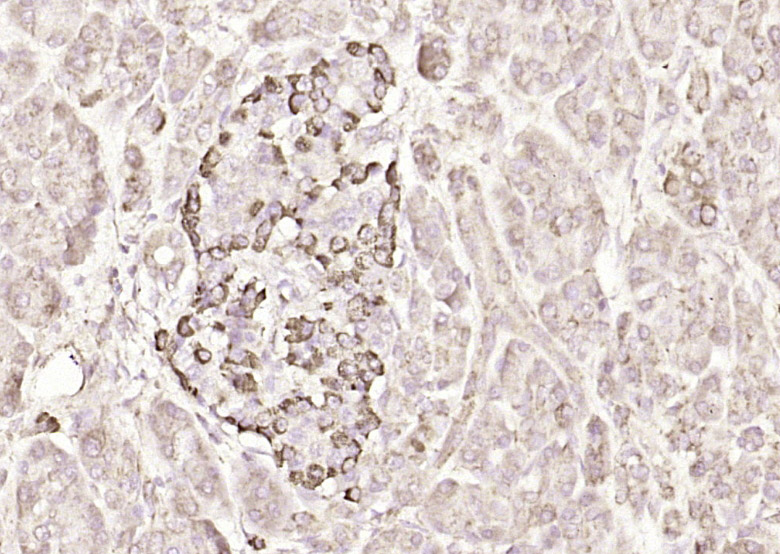 14 - IQCJ Rabbit pAb AP94329